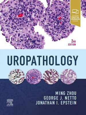 cover image of Uropathology E-Book